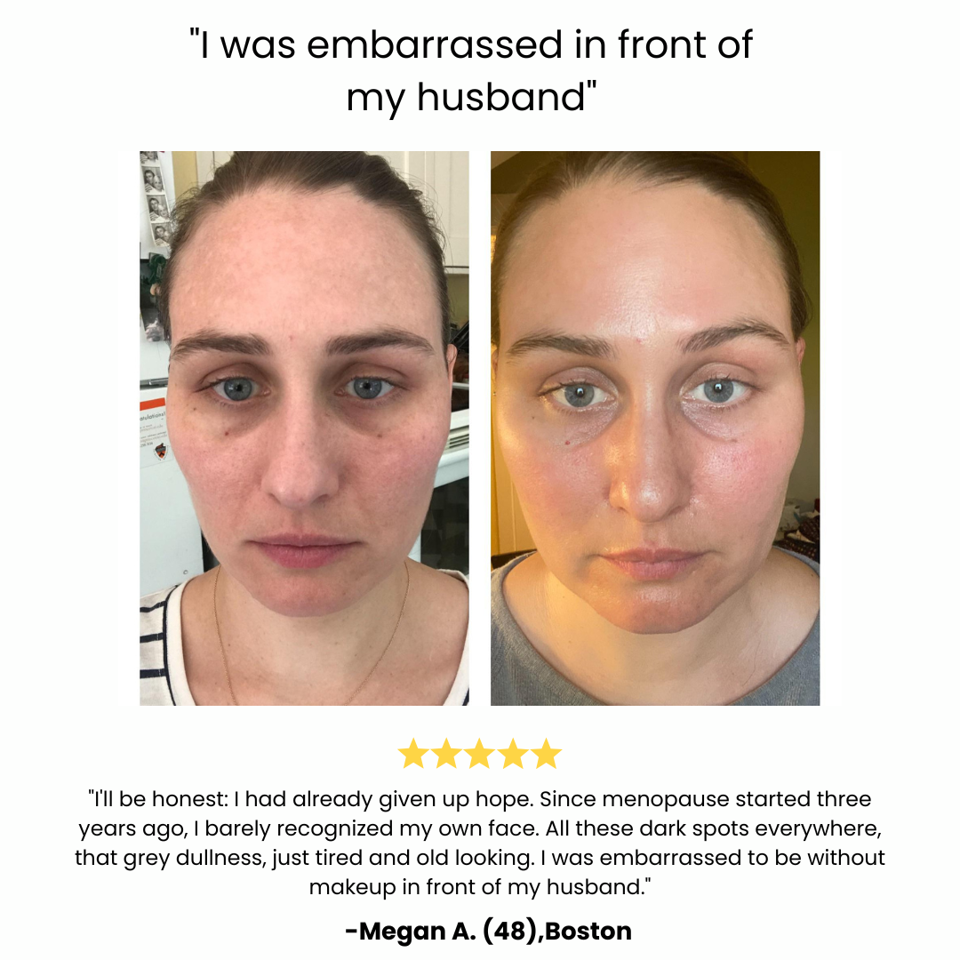 Spezialpflege für hormonell veränderte Haut