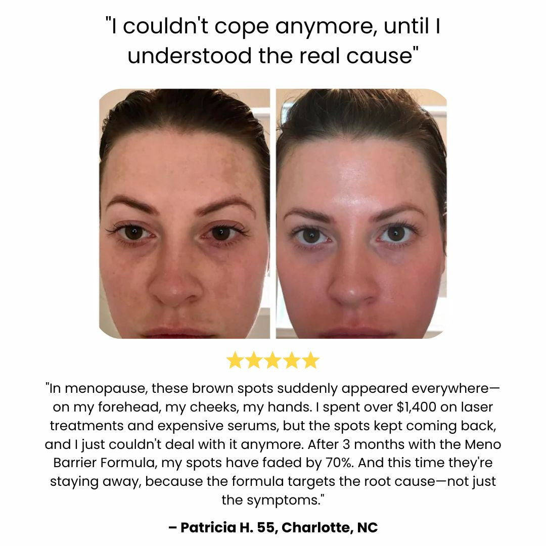 Spezialpflege für hormonell veränderte Haut