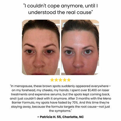 Spezialpflege für hormonell veränderte Haut