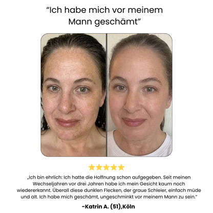 Special care for hormonally altered skin